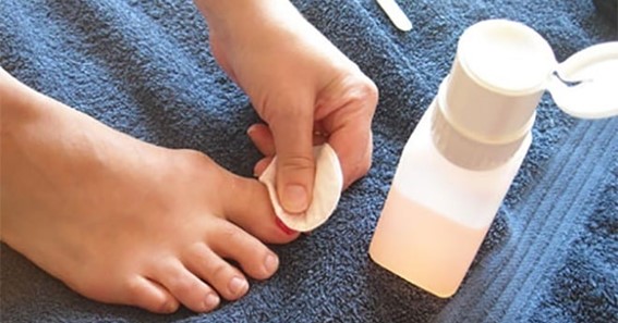 Steps To A French Pedicure At Home