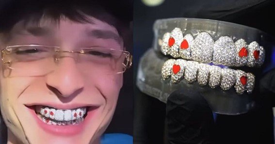 Does Peso Pluma Wear Diamonds On His Teeth